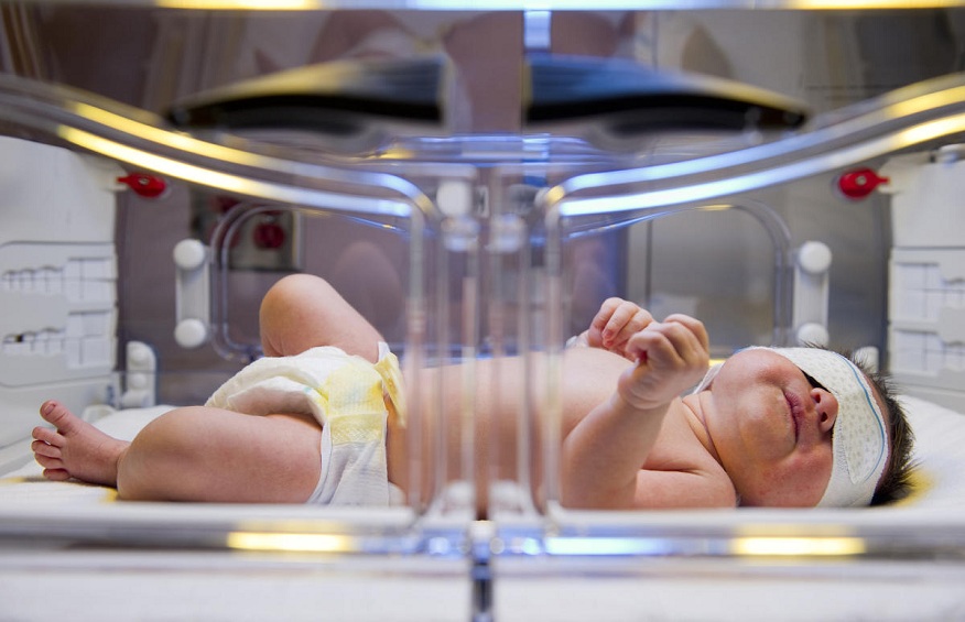 What Should You Know About Jaundice in New Born Babies?